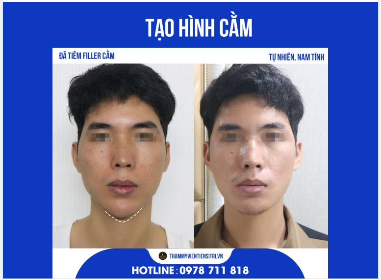 BẤT NGỜ Anh trai có diện mạo tự nhiên - cân đối hơn