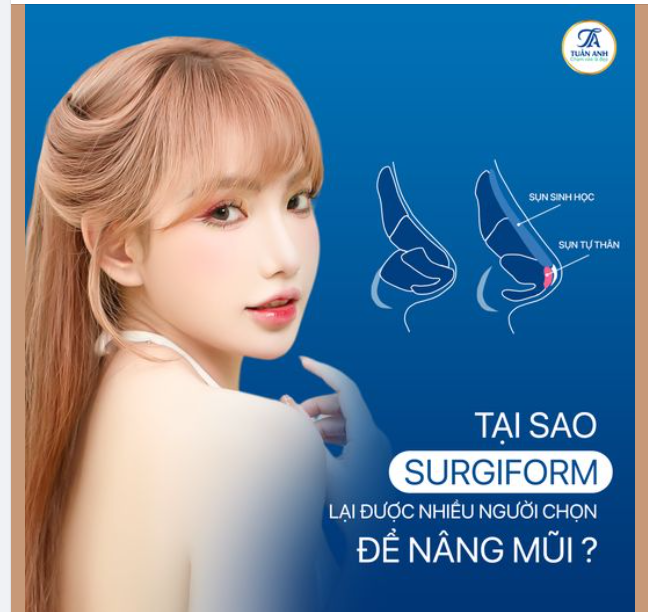 TẠI SAO SỤN SURGIFORM LẠI ĐƯỢC NHIỀU NGƯỜI CHỌN ĐỂ NÂNG MŨI?