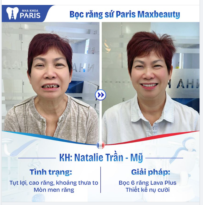 Chỉ còn chưa đầy 2 tháng nữa là Tết. Cùng Paris tân trang nhan sắc, tân trang nụ cười nhé!