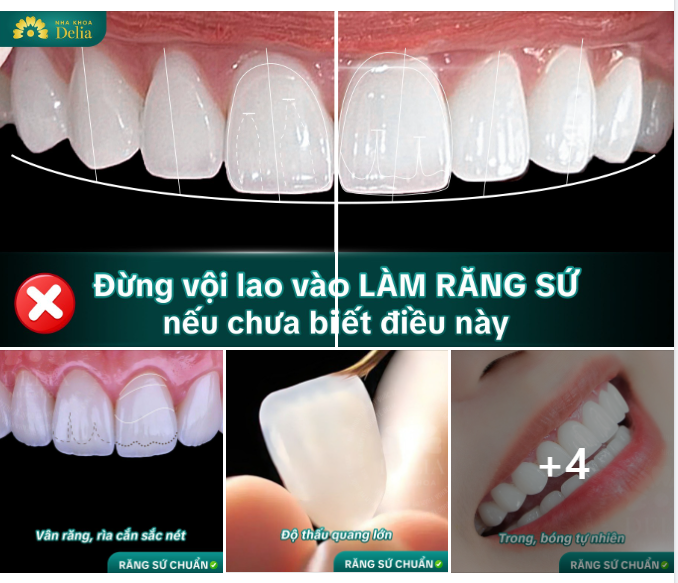 Chọn nha khoa uy tín - an toàn để không tiền mất tật mang  khách hàng nhé!
