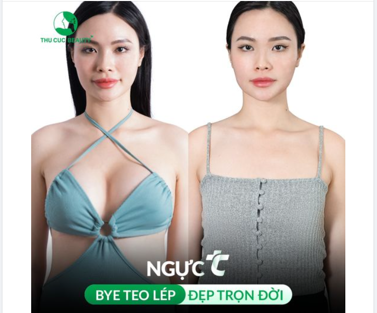 CHỈ 6 SUẤT GIÁ GỐC NGỰC TC HÔM NAY DỊP GREEN XMAS