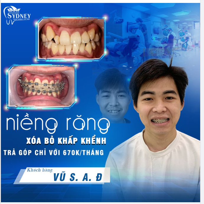NỤ CƯỜI CỦA KHÁCH HÀNG – NIỀM VUI CỦA NHA KHOA HÀ NỘI SYDNEY