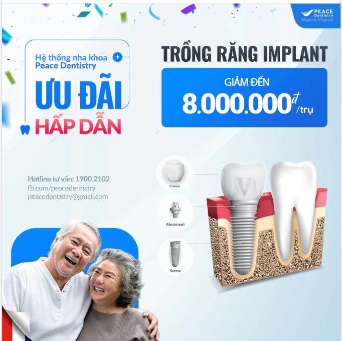 ĐÓN NĂM MỚI, TRỒNG RĂNG MỚI CÙNG ƯU ĐÃI HẤP DẪN TẠI PEACE DENTISTRY