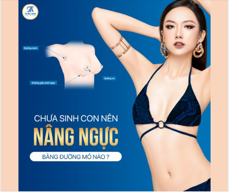 Chưa sinh con nên nâng ngực bằng đường nào?