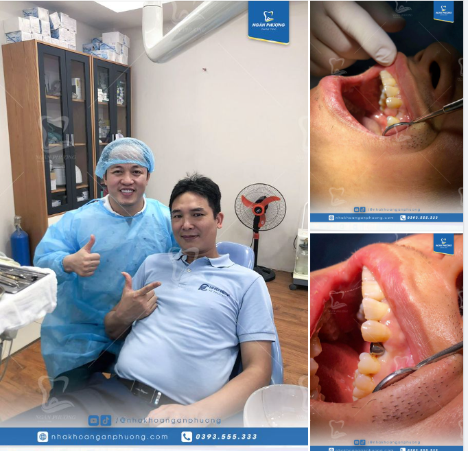 Phục hình một lần, an tâm một đời