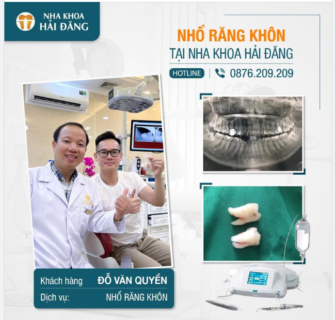 TẠM BIỆT NHỮNG CHÚ RĂNG KHÔN SIÊU KHÓ