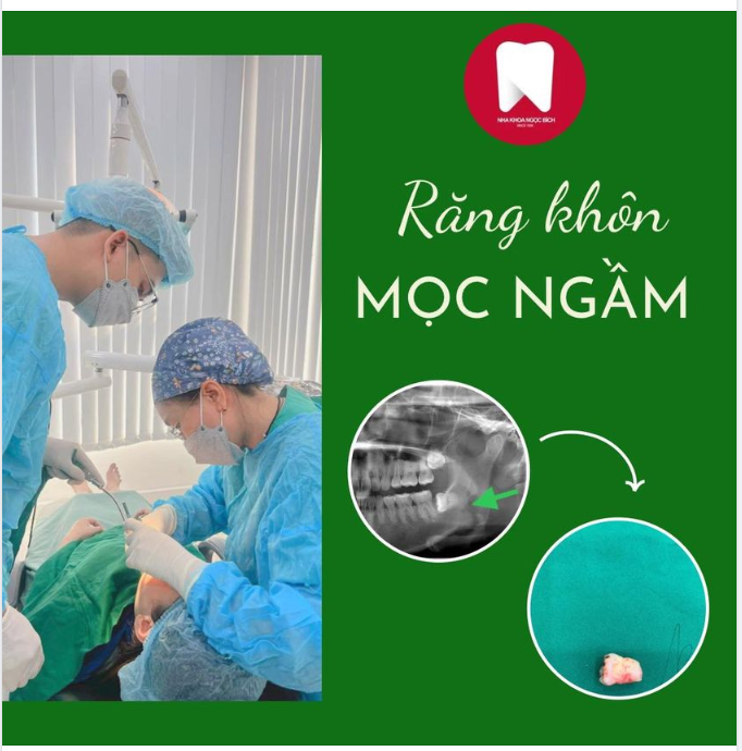 RĂNG KHÔN MÀ LẠI KHÔNG HỀ KHÔN