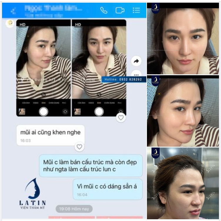 Mũi bán cấu trúc nhưng "xịn" như mũi cấu trúc