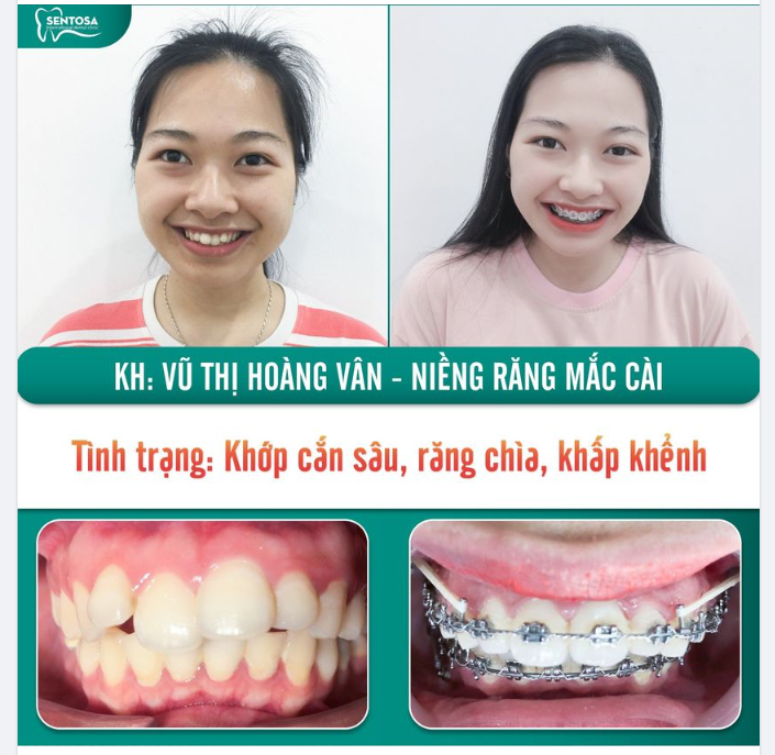 Dám thay đổi nụ cười, dám tự tin trong tương lai!