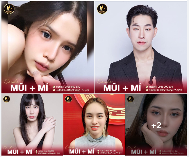 COMBO MŨI MÍ XUẤT SẮC TẠI DR. HOẠT