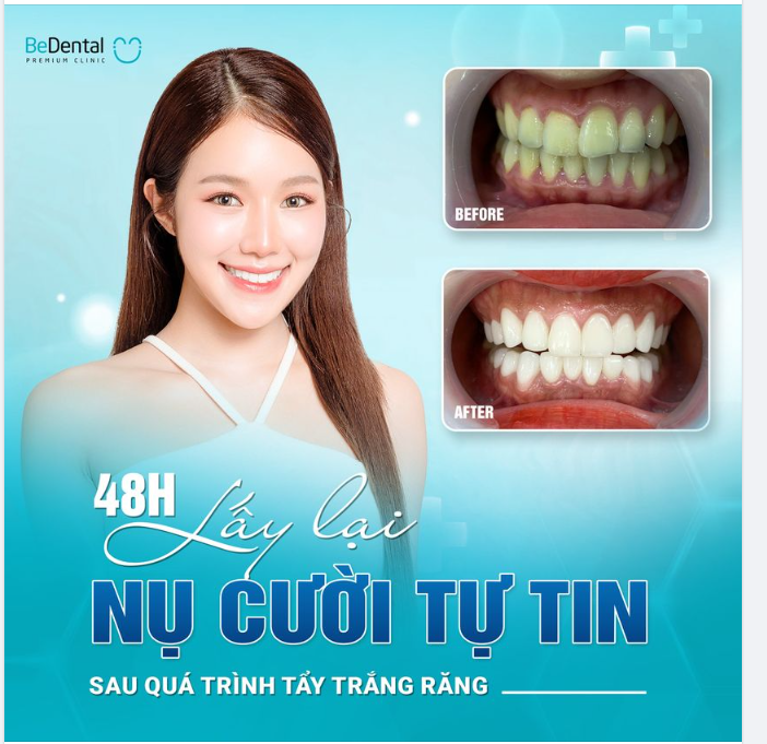 CHỈ CẦN 48H LẤY LẠI NỤ CƯỜI TỰ TIN VỐN CÓ!