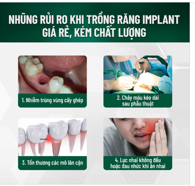 NHỮNG RỦI RO KHI TRỒNG RĂNG IMPLANT KÉM CHẤT LƯỢNG