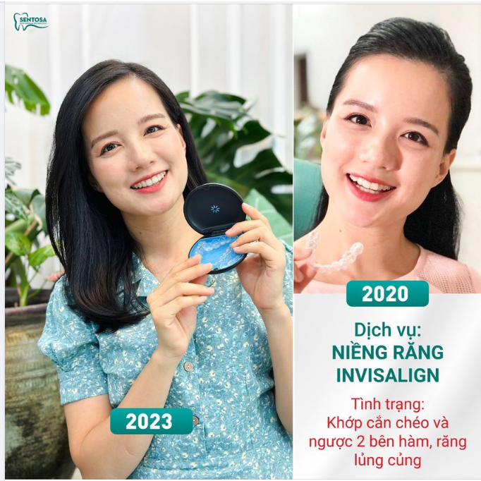 ĐĂNG KÝ NHẬN 5 TRIỆU TIỀN MẶT TẠI NHA KHOA SENTOSA
