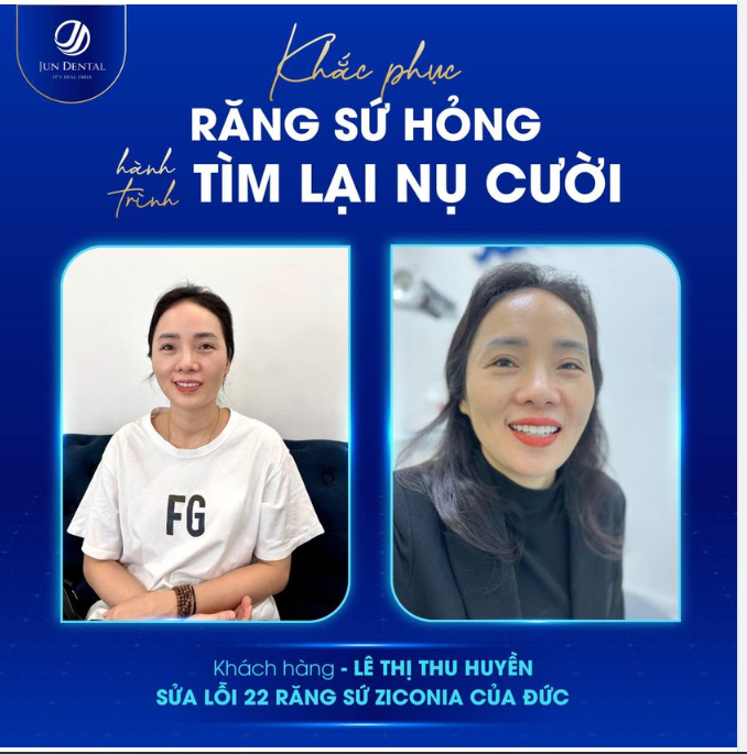 KHẮC PHỤC RĂNG SỨ HỎNG - HÀNH TRÌNH TÌM LẠI NỤ CƯỜI