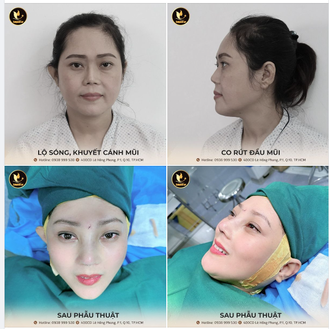 CÁI KẾT MỸ MÃN KHI GẶP BÁC SĨ HOẠT