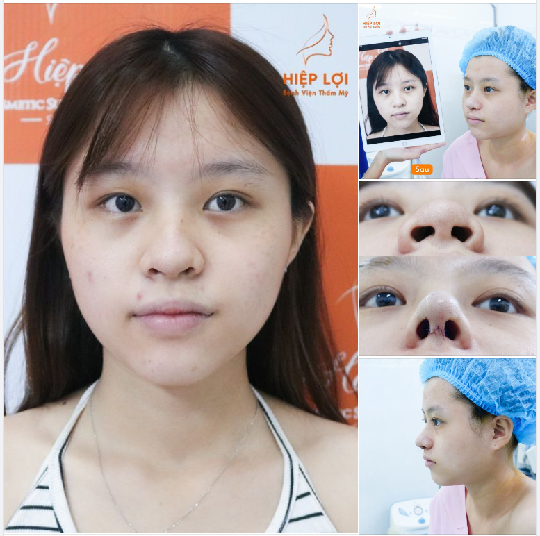 MỖI QUYẾT ĐỊNH ĐỀU TẠO NÊN BƯỚC NGOẶT CUỘC ĐỜI
