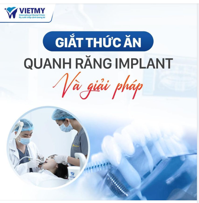 GIẮT THỨC ĂN QUANH RĂNG  IMPLANT