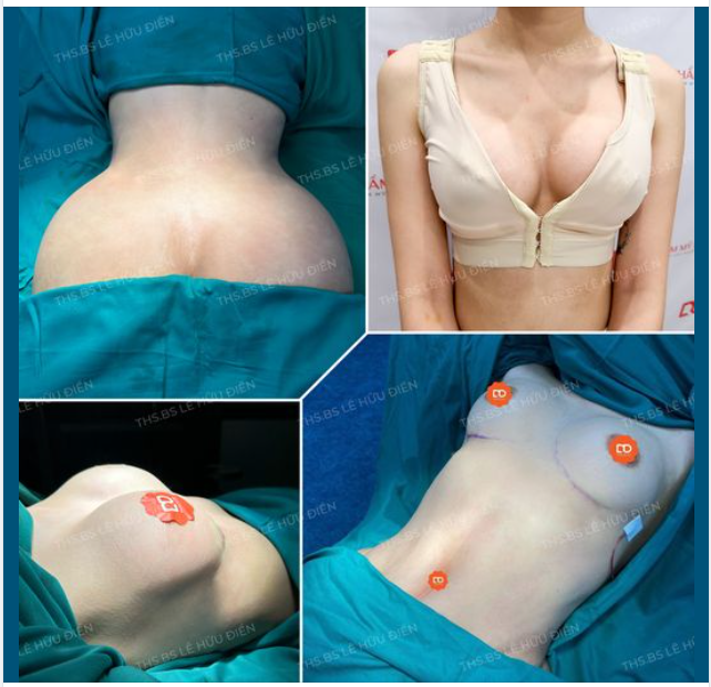 Năm nay chị em đã kịp làm đẹp độ body nóng bỏng chưa ạ?
