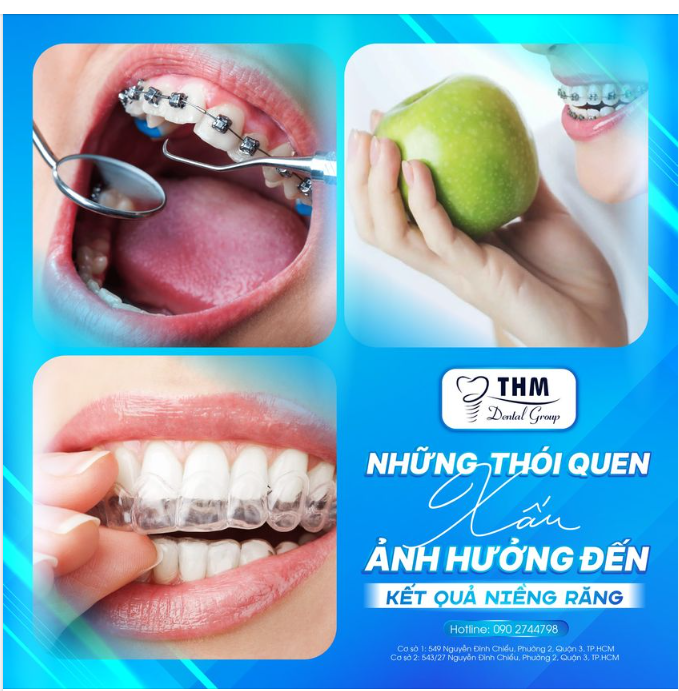 NHỮNG THÓI QUEN XẤU ẢNH HƯỞNG TỚI KẾT QUẢ NIỀNG RĂNG