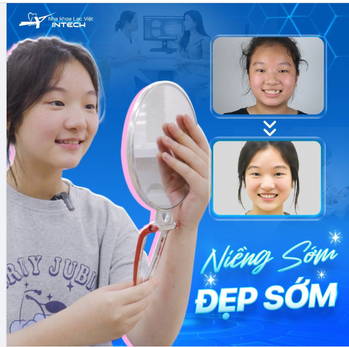 NIỀNG SỚM ĐẸP SỚM - BẬT MÍ THỜI ĐIỂM VÀNG ĐỂ NIỀNG RĂNG!