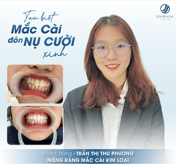 Tạm Biệt Mắc Cài - Đón Nụ CườI Xinh