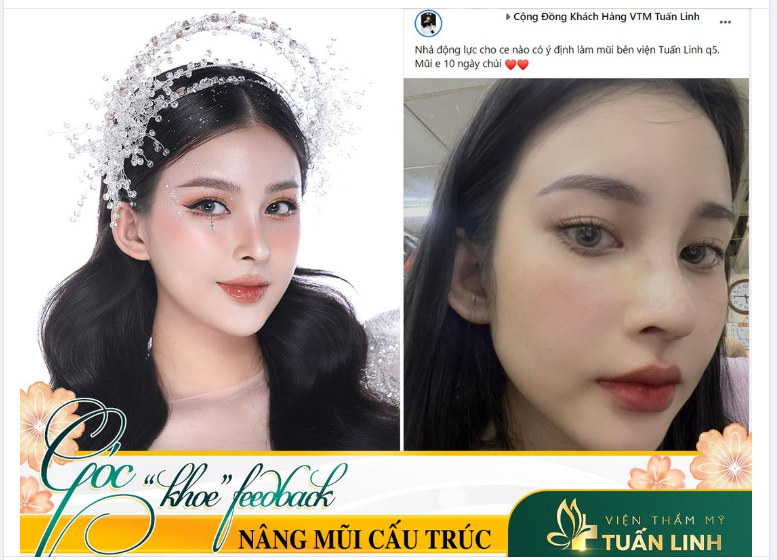 Gửi chị em chút động lực để làm đẹp đón Noel đây ạ!
