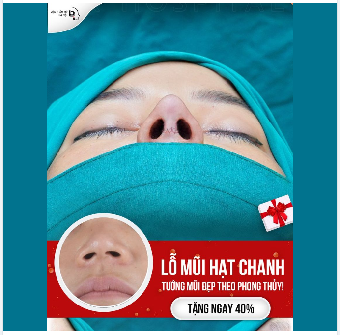 LỖ MŨI HẠT CHANH - TƯỚNG MŨI ĐẸP THEO PHONG THỦY!