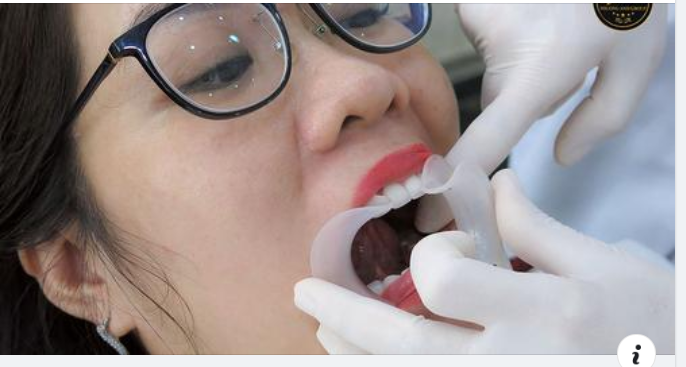 Đối tượng nào nên bọc răng sứ ?