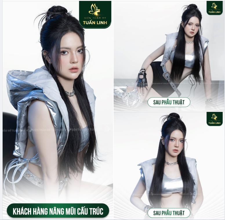 Thần thái sang chảnh, cuốn hút sau nâng mũi cấu trúc của cô nàng Hotgirl 9X!!!