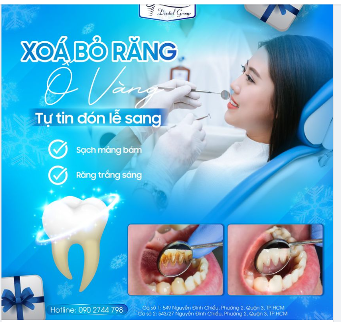 XÓA BỎ RĂNG Ố VÀNG - TỰ TIN ĐÓN LỄ SANG