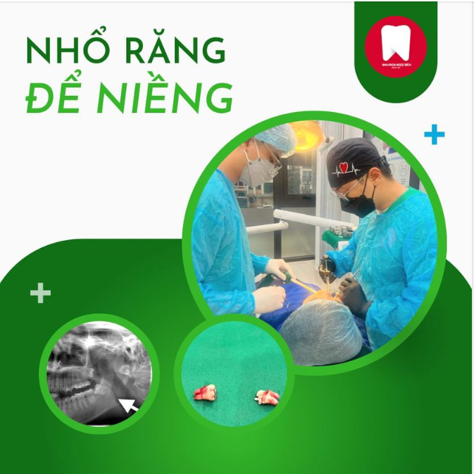 Có nhất thiết phải nhổ răng để niềng không ?
