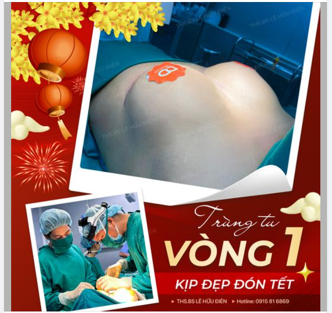 Kiến tạo ngực CĂNG, TĂNG BẬT SIZE, SĂN CHẮC chỉ sau 60 phút