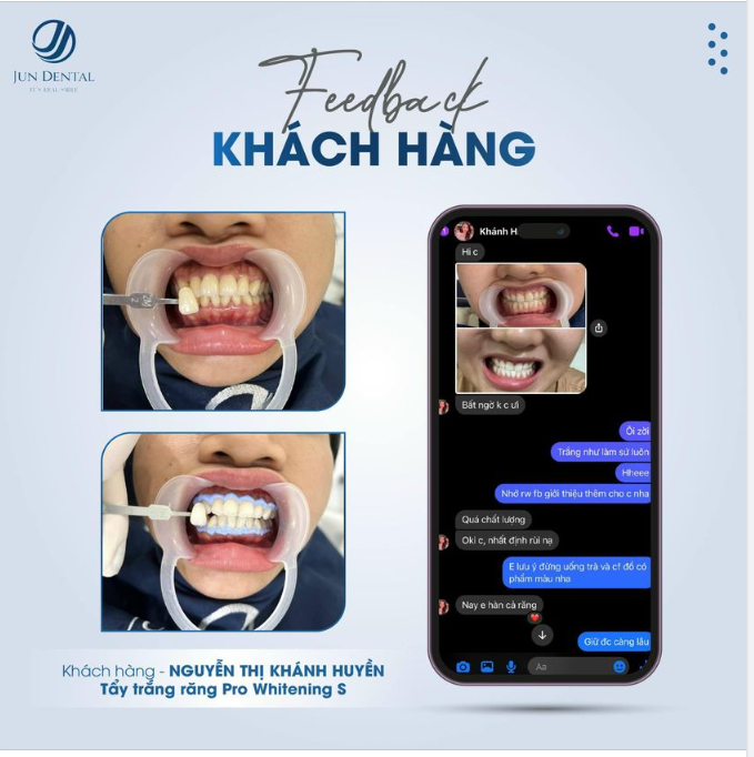 Cảm ơn quý khách hàng luôn ủng hộ và lựa chọn Jun Dental hành trình kiến tạo nụ cười tự tin và khỏe mạnh.