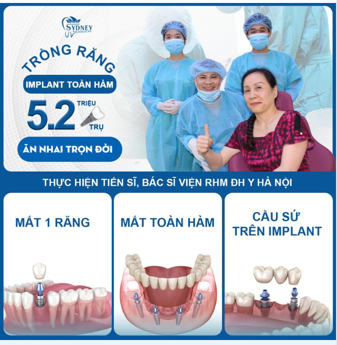 CẤY GHÉP IMPLANT LÀ GÌ?