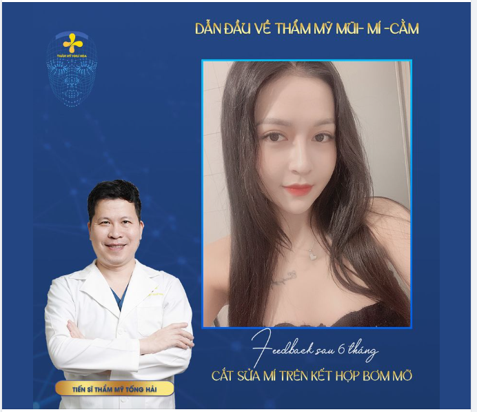 Kết quả của khách hàng sau 6 tháng sửa mí.