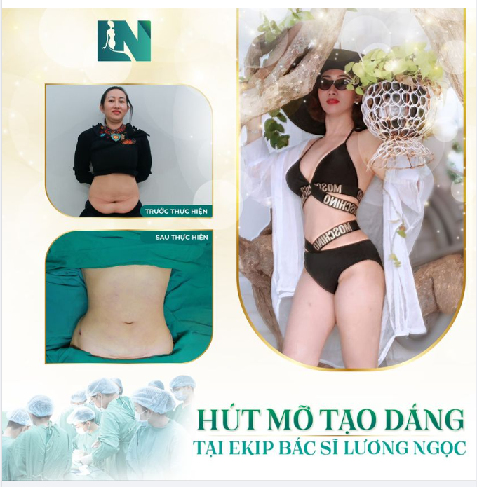 ĐÂU LÀ GIẢI PHÁP HOÀN HẢO ĐỂ SỞ HỮU EO THON DÁNG GỌN ĐỂ KỊP ĐÓN XUÂN?