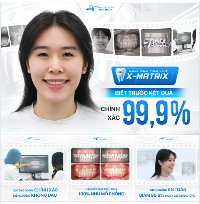 3 LỢI ÍCH KHI BIẾT TRƯỚC KẾT QUẢ NIỀNG RĂNG CHÍNH XÁC 99.9% VỚI X-MATRIX!