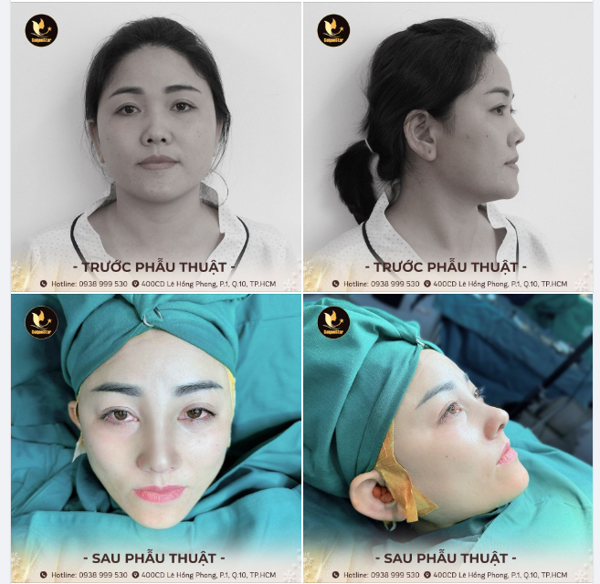 MŨI XINH - ĐÓN NĂM MỚI