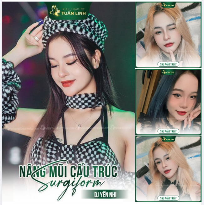 Nữ DJ Yến Nhi Flex nhẹ chiếc mũi phong thủy của cô ấy!!
