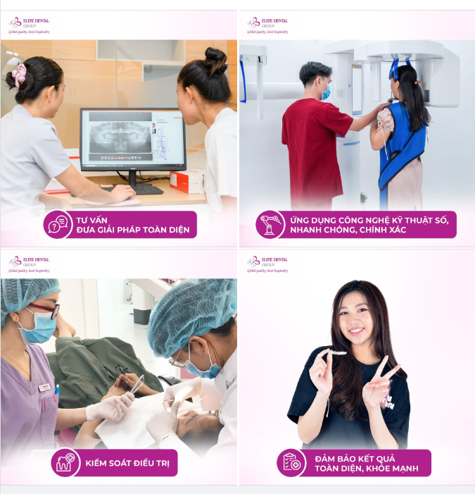 TẠI SAO NÊN ĐIỀU TRỊ NIỀNG RĂNG TRONG SUỐT CHUYÊN SÂU TẠI ELITE DENTAL?