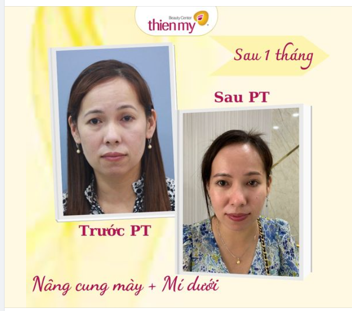COMBO NÂNG CUNG MÀY, MÍ DƯỚI - TÌM LẠI THANH XUÂN CHO ĐÔI MẮT