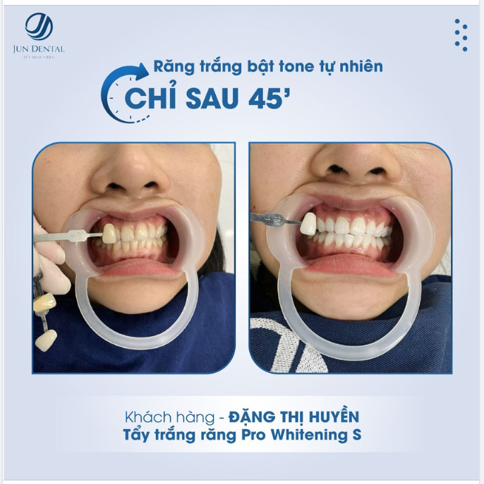 Giáng sinh đang đến gần, bạn đã sẵn sàng cho một nụ cười rạng ngời chưa?