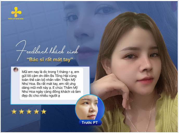 FEEDBACK SAU 1 THÁNG NÂNG MŨI