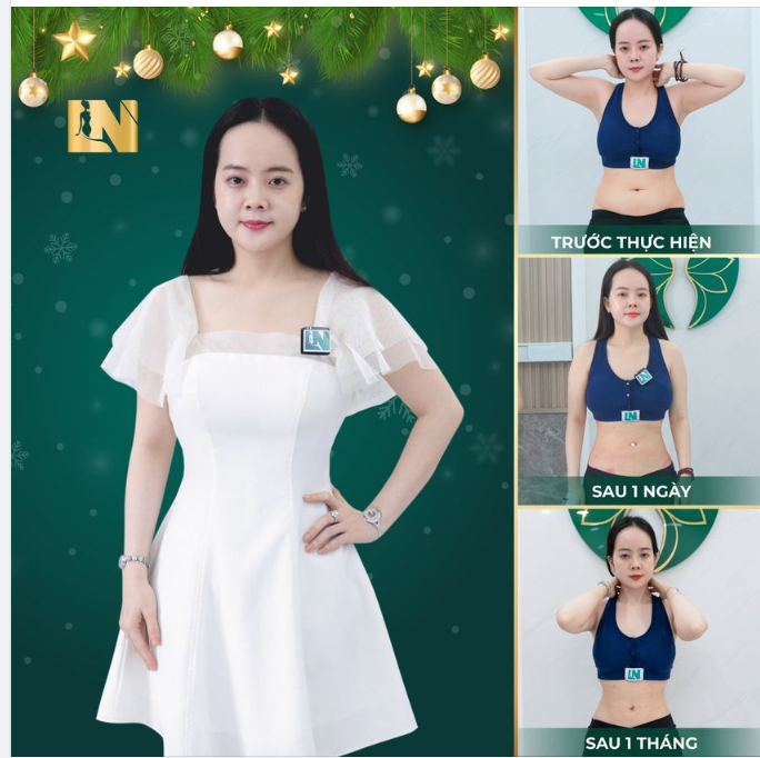 HÚT MỠ TẠO DÁNG - ĐÓN CHÀO GIÁNG SINH