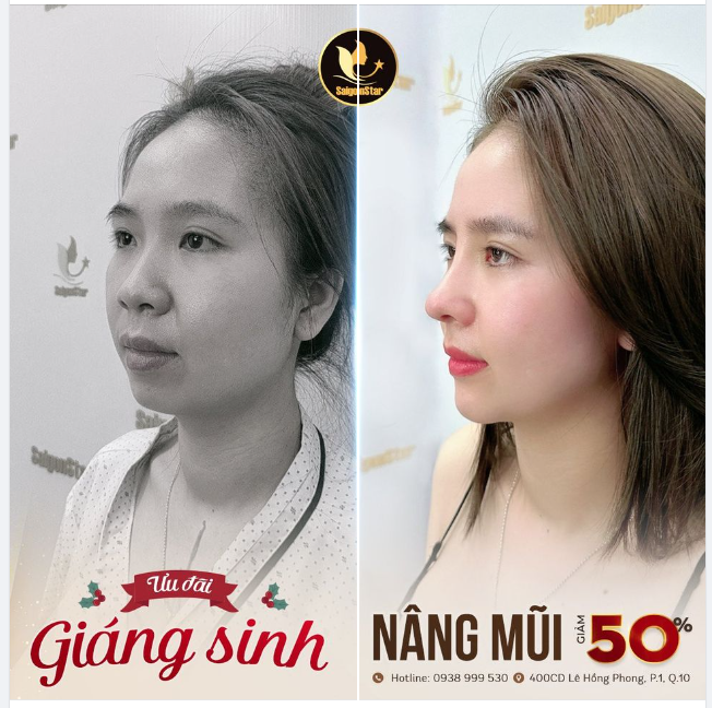 GIÁNG SINH XINH ĐẸP VÀ ẤM ÁP CÙNG BÁC SĨ HOẠT