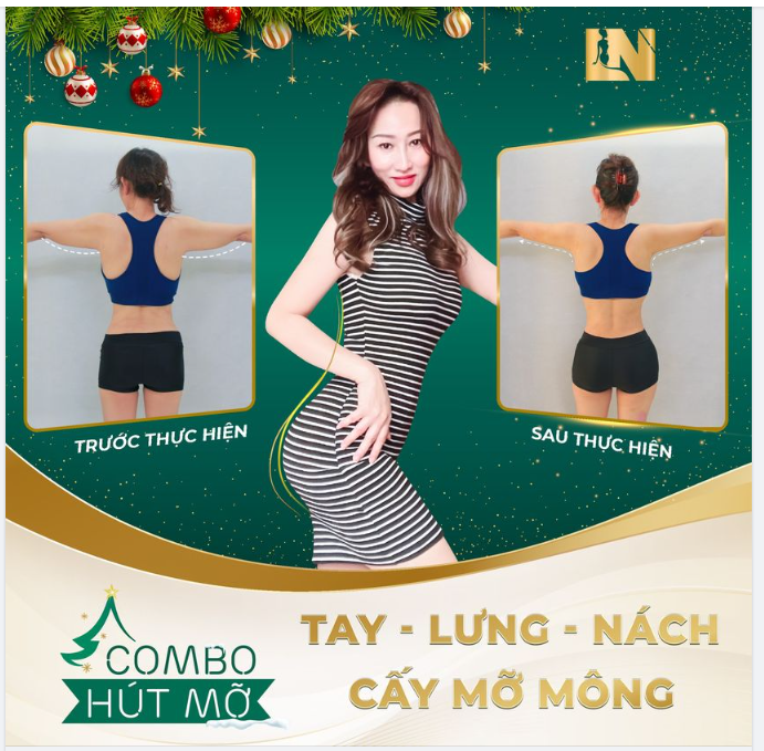 COMBO HÚT MỠ TAY - LƯNG - NÁCH KẾT HỢP CẤY MỠ MÔNG
