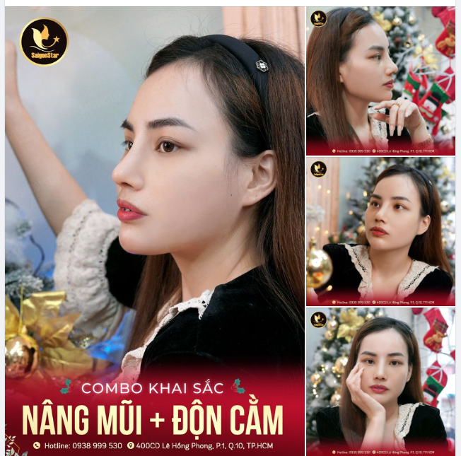 Giáng sinh an lành . Đừng quên Bác sĩ Hoạt vẫn đang có chương trình siêu ưu đãi và quà cực xinh nha chờ chị em nha!