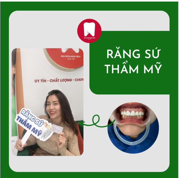 RĂNG SỨ THẨM MỸ - CƯỜI SANG NHƯ Ý