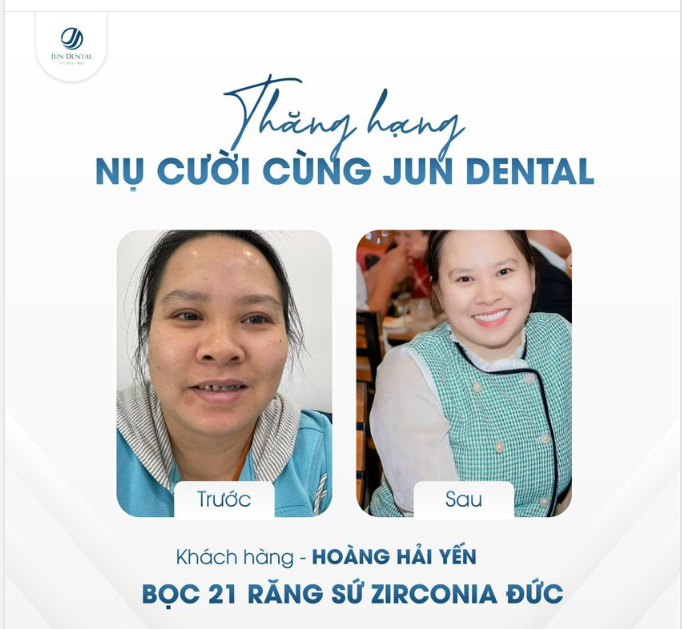THĂNG HẠNG NỤ CƯỜI CÙNG JUN DENTAL