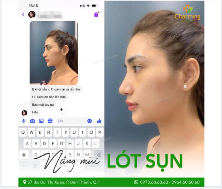Thấy nàng khách feedback chiếc mũi lót sụn, thu chóp như ý, khen bác Khanh mát tay mà Charming cũng thấy mát lòng, nhìn thêm chiếc ảnh xinh đẹp của nàng khách lại thấy mát mắt.
